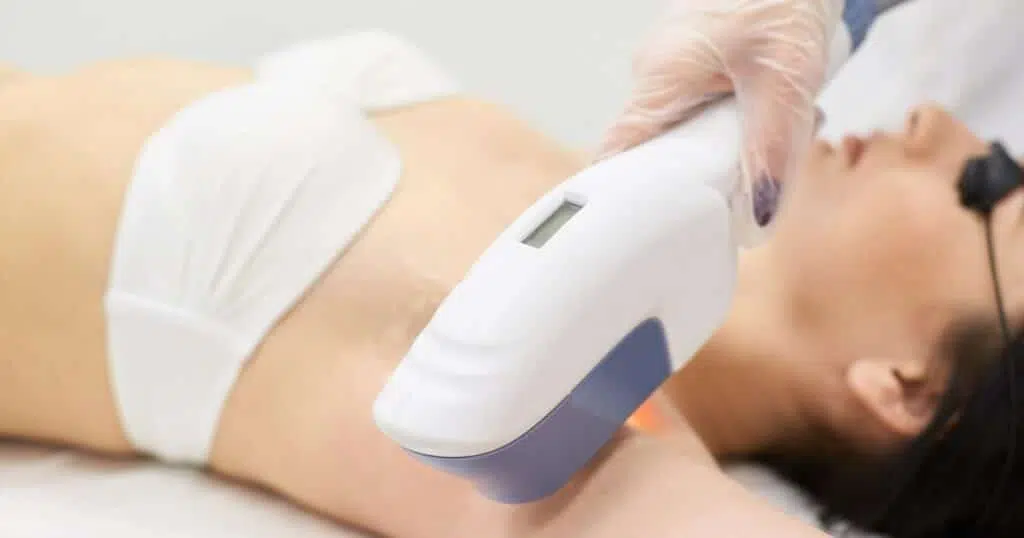 Οι 6 Μέθοδοι Αποτρίχωσης με + & - Φωτόλυση, μέθοδοι αποτρίχωσης